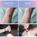 Joint Muscle Reliever LED light therapy for joint pain target treatment Supplier